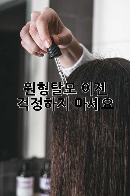 원형탈모, 이젠 걱정하지 마세요! 원형탈모, 이젠 걱정하지 마세요!